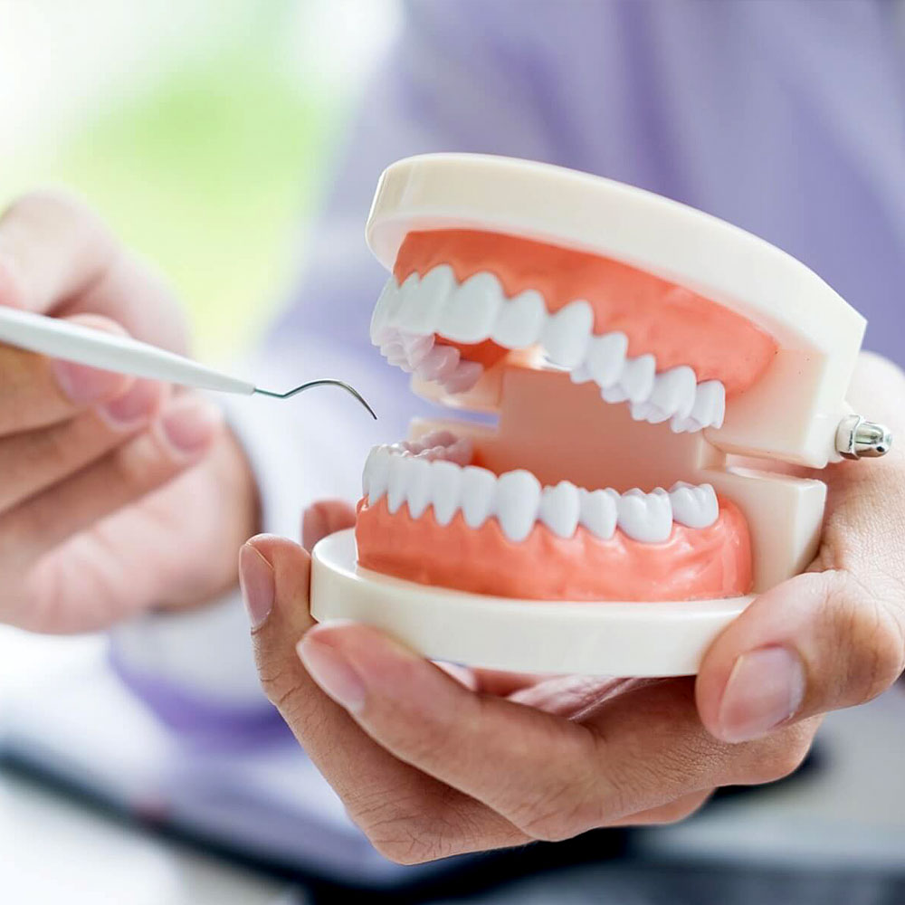 زراعة الأسنان